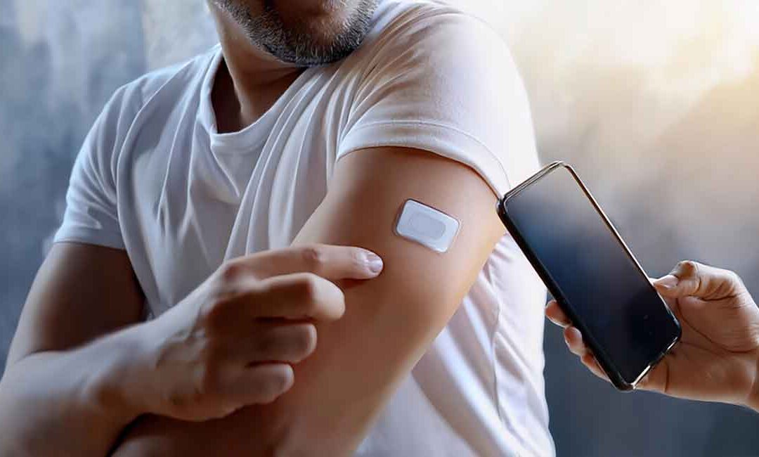 Continuous Glucose Monitoring (CGM) – An Evolving Innovation Landscape